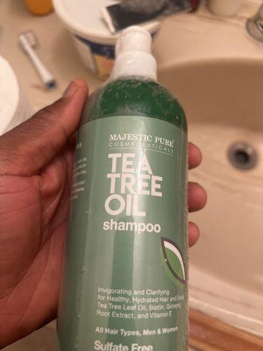 Great for itchy scalp